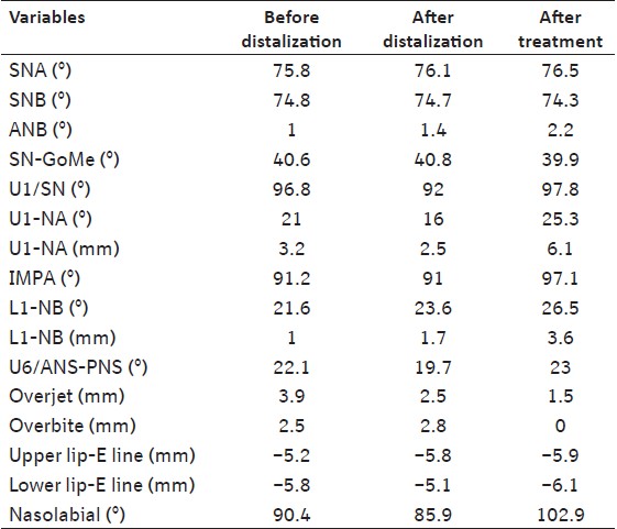 Table 1: The measurements of the patient before, after distalization and after orthodontic treatment