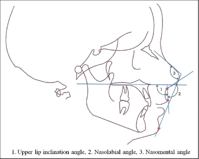 Figure 5: Angular measurements
