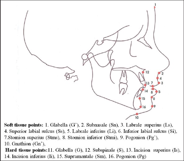Figure 1: Cephalometric points and landmarks used in the study