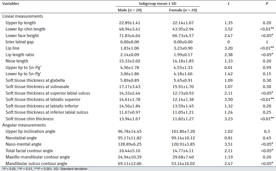 Table 3: Mean and SD values of soft tissue variables in Group-A (normal occlusion) and its comparison in male and female
