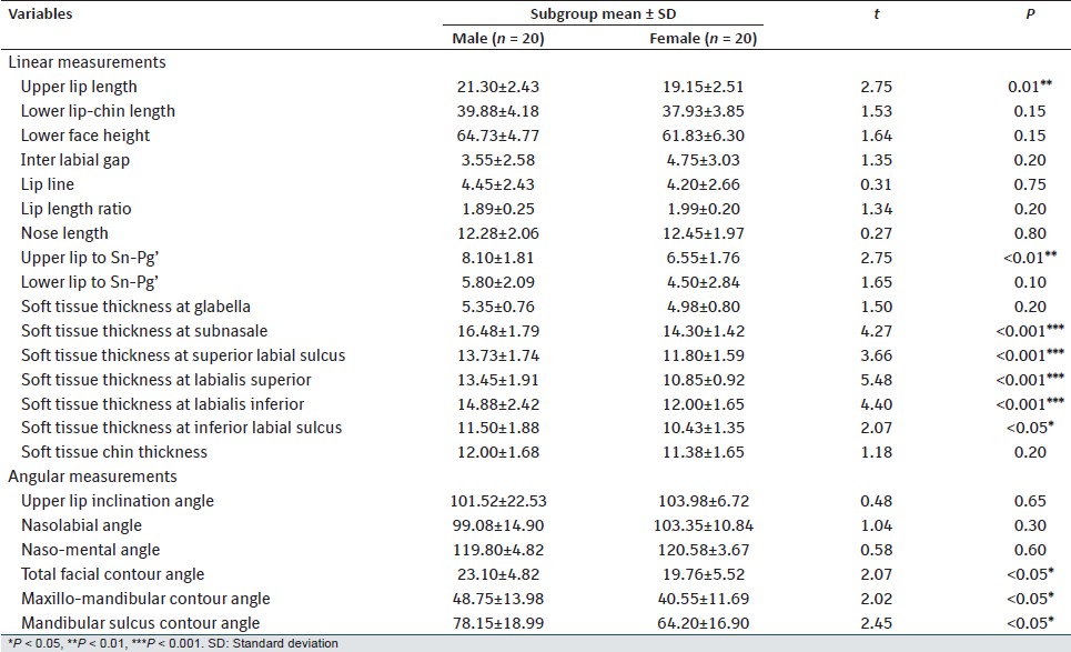 Table 4: Mean and SD values of soft tissue variables in Group-B (Class-II, Division-1 malocclusion) and its comparison in male and female