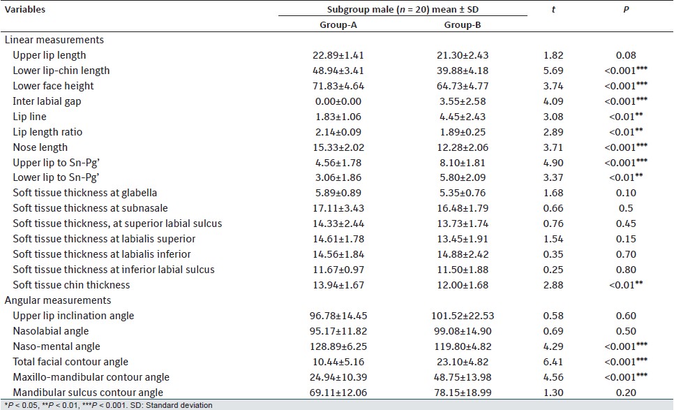Table 5: Comparison of soft tissue variables in Group-A (normal occlusion) versus Group-B (Class-II, Division-1 malocclusion) in male