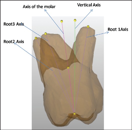 Figure 1: Geometric model of the tooth under consideration