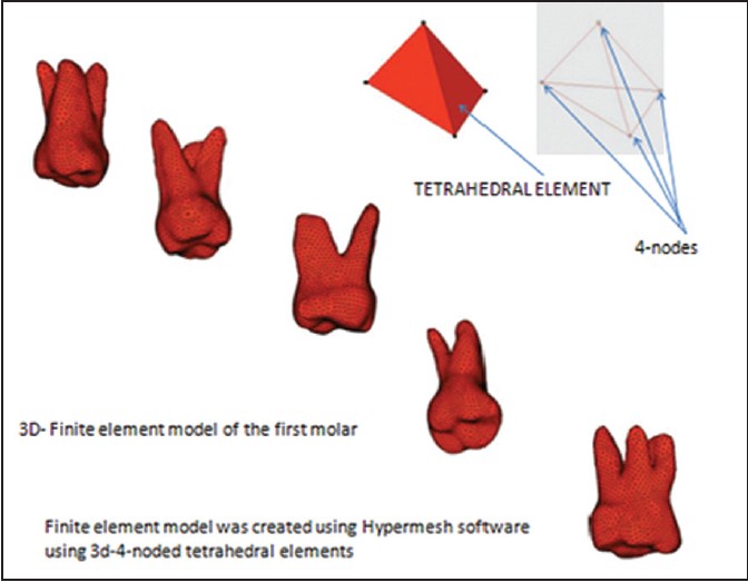 Figure 4: Three-dimensional finite element model of maxillary first molar
