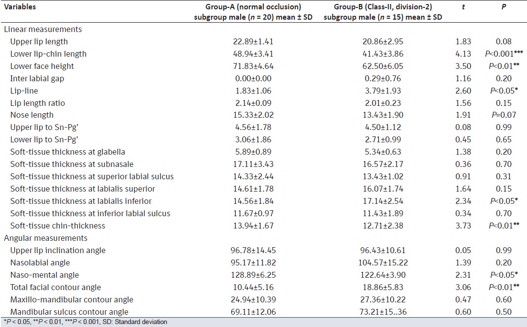Table 5: Comparison of soft-tissue variables in Group-A (normal occlusion) versus Group-B (Class-II division-2 malocclusion) in male