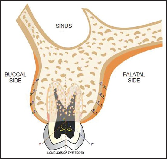 Figure 2: Schematic representation-coronal section view of structures related during mini-implant placement in maxilla, points marked at different levels