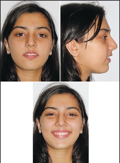 Figure 9: Posttreatment extra-oral photographs