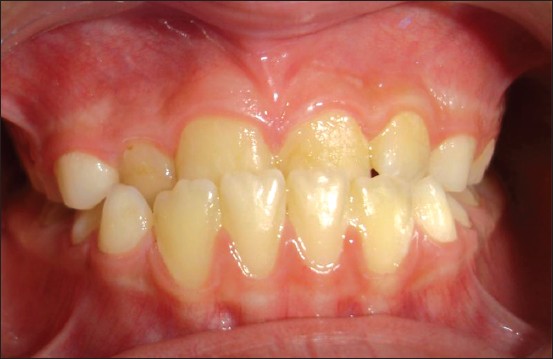 Figure 4: Frontal-intraoral view