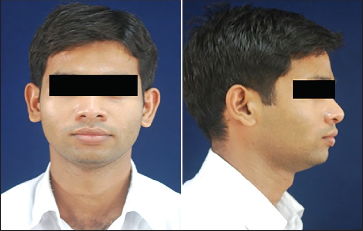 Figure 2: Reference set of photographs for male frontal and profile