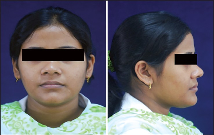 Figure 3: Reference set of photographs for female frontal and profile