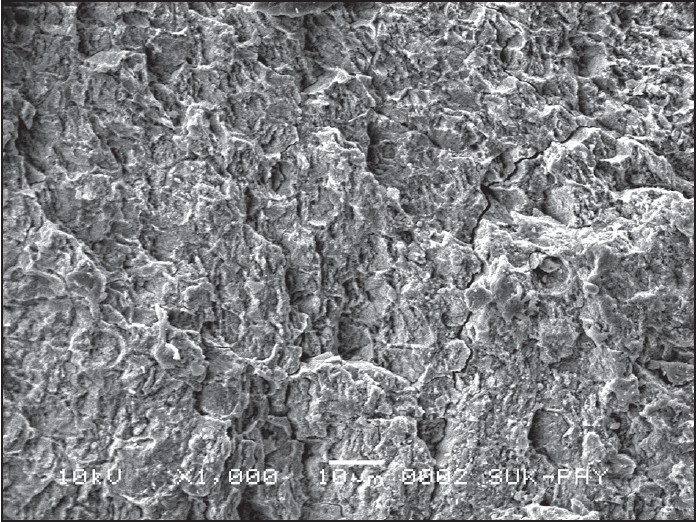 Figure 6: Scanning electron microscopic image of Group-3 sample after etching with erbium-doped yttrium aluminum garnet laser at 1.5-W power