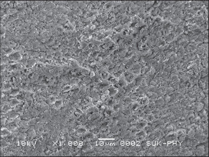 Figure 4: Scanning electron microscopic image of Group-1 sample after etching with 37% phosphoric acid
