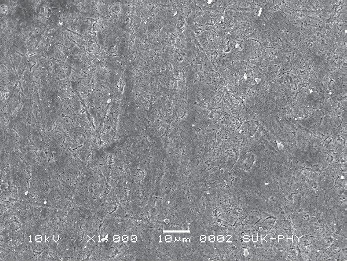 Figure 5: Scanning electron microscopic image of Group-2 sample after etching with self-etching primer