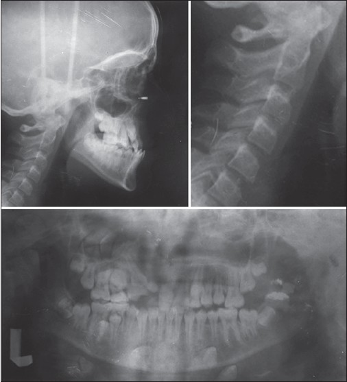 Figure 3: Pre-treatment radiographs