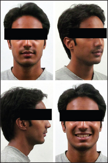 Figure 4: Facial photographs