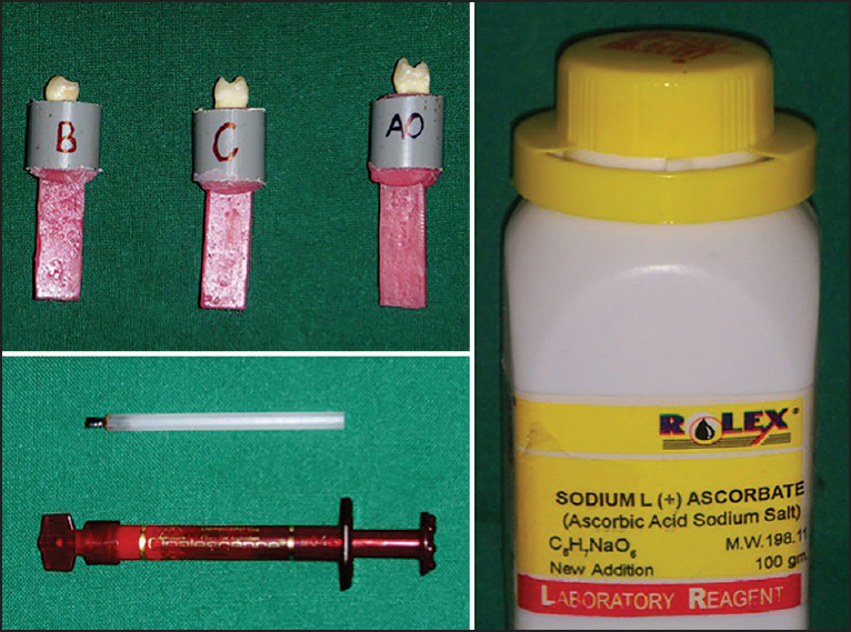 Figure 1: Mounted specimens; Ultradent Opalascence Xtra whitening agent and 10% sodium ascorbate (antioxidant)