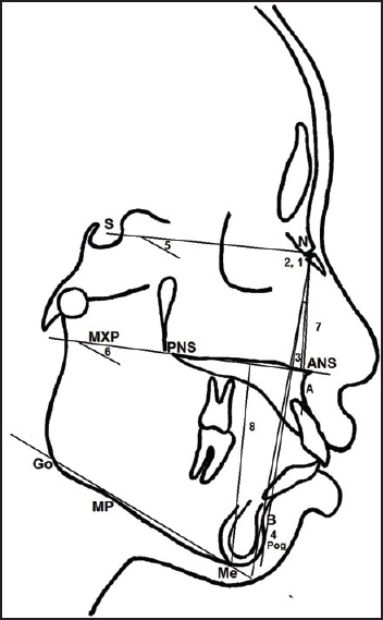 Figure 1: Skeletal variables: (1) SNA, (2) SNB, (3) ANB, (4) SNPog, (5) SNMP, (6) MMPA, (7) upper facial height, (8) lower facial height