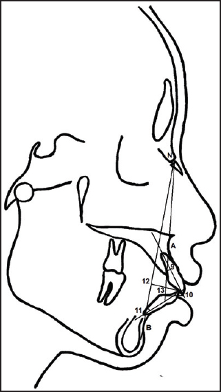 Figure 2: Dental variables: (9) U1NA (°), (10) U1NA (mm), (11) L1-NB (°), (12) L1NB (mm), (13) Ul-Ll