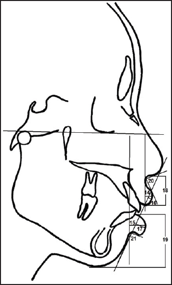 Figure 3: Soft-tissue variables: (14) ULTH, (15) LLTH, (16) UL-E, (17) LL-E, (18) upper lip length, (19) lower lip length, (20) nasolabial angle, (21) mentolabial angle