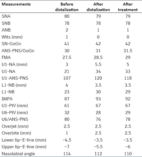 Table 1: Cephalometric measurements of the patient before and after distalization and after orthodontic treatment