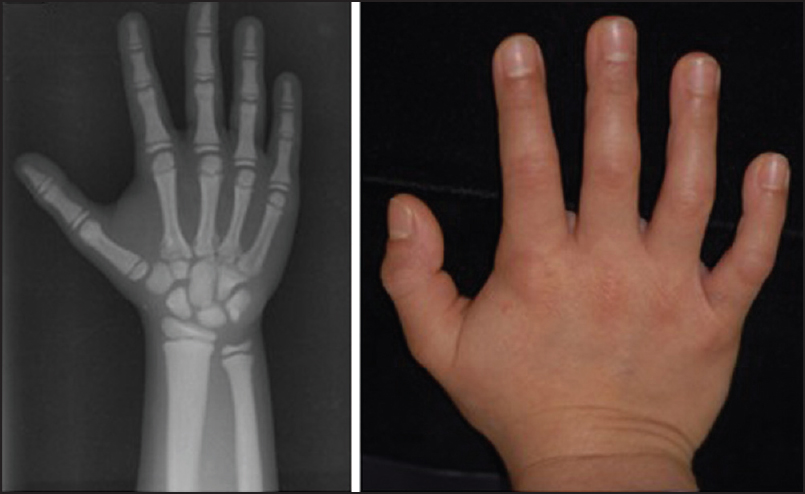 Figure 2: The photographs of the patient's fingers and nails