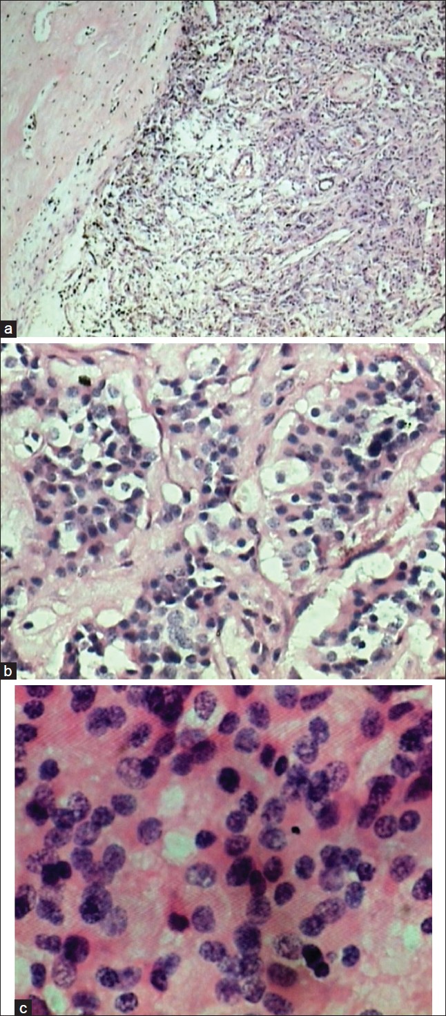 Figure 5: (a) Squash slide; (b) Histopathological slides: suggestive 