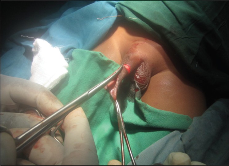 Figure 5: Dorsal slit