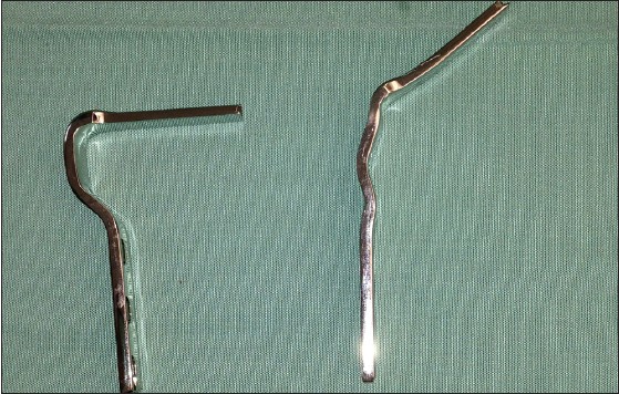 Figure 1: The technique is presented by the use of a blade plate for femoral offset adjustment. The plate is bent from 90° to approximately 130°