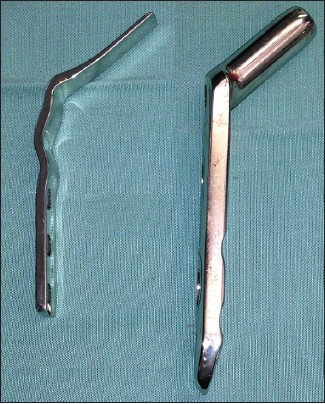 Figure 2: The blade plate is recommended for small femoras and DHS for large femoras