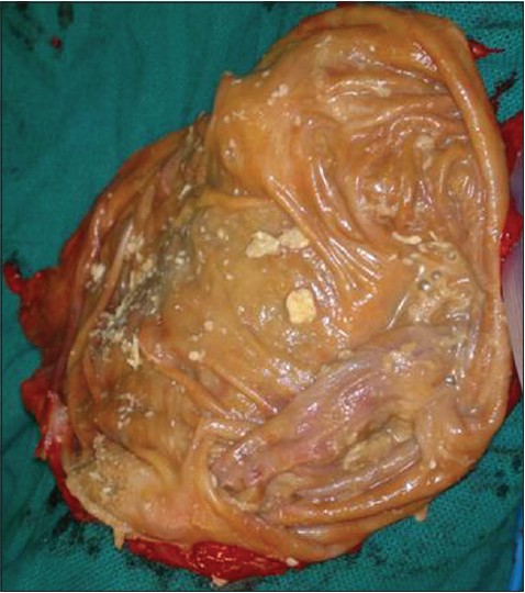 Figure 5: Cut section of necrosed testes