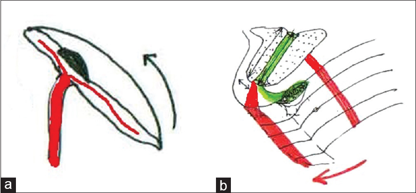 Figure 3: (a and b) Schematic pictures of the flap